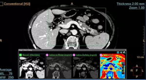 mágenes que salvan vidas: radiología en enfermedades cerebrovasculares, cardiovasculares y onconeurológicas.