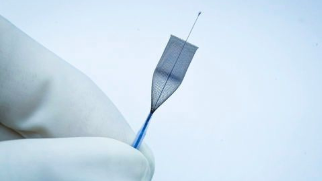 Stent