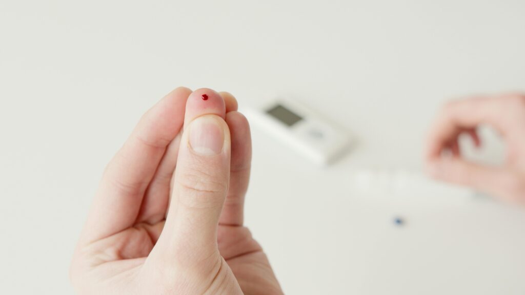 Diabetes secundaria
