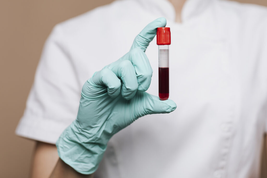 Donación Voluntaria de Sangre